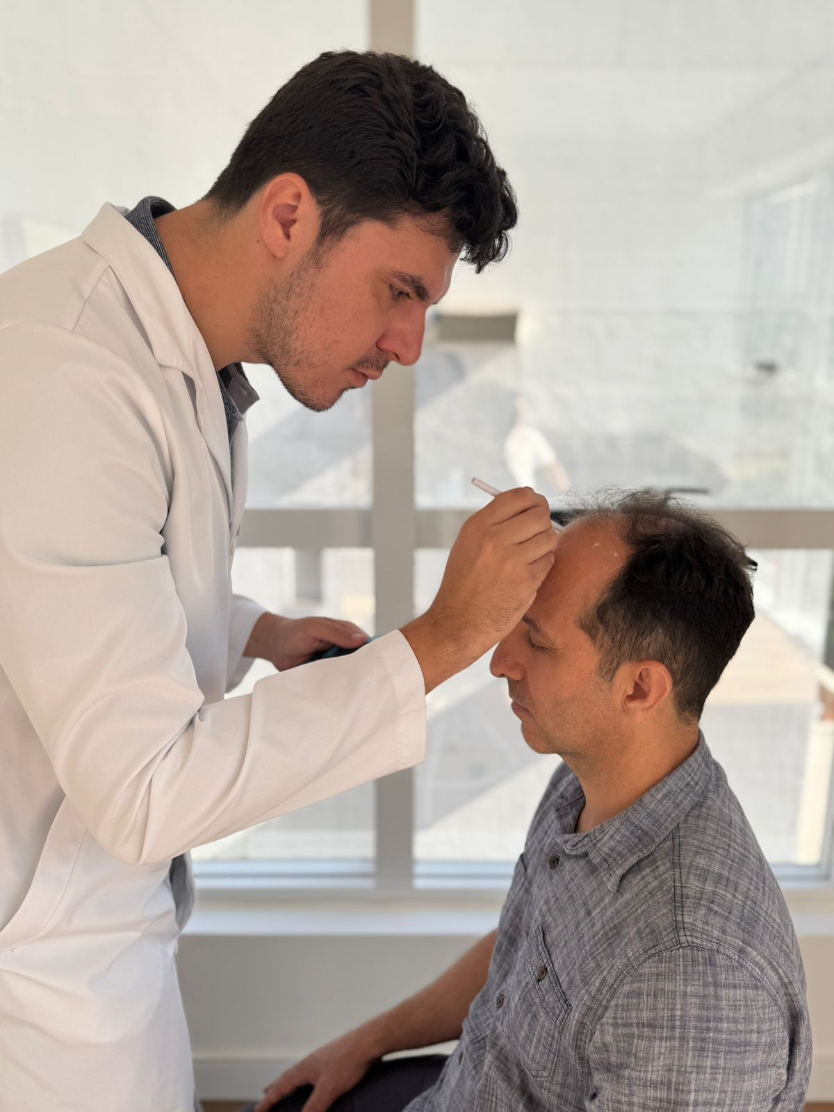 Planejamento e Desenho da linha frontal (hairline) para transplante capilar