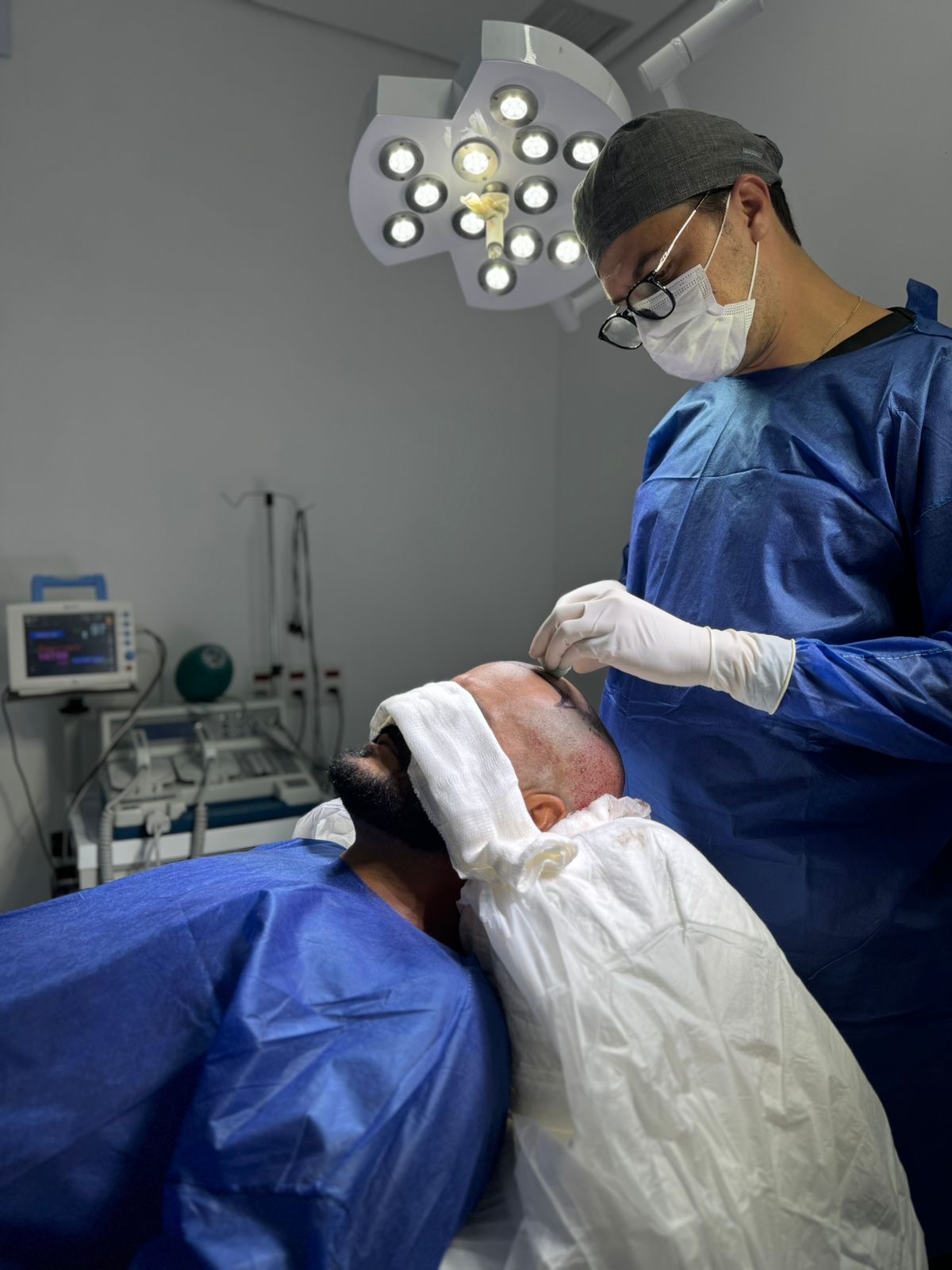 Paciente Antes do MINI Transplante Capilar 3